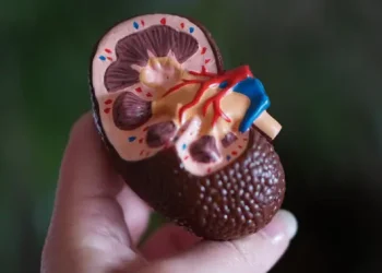 Penanganan Batu Ginjal Tanpa Operasi Terbuka Kini Mungkin Dilakukan