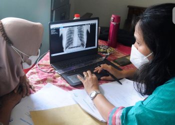 601 Ribu Kasus Tuberkulosis Ditemukan, 90 Persen Sudah Mulai Pengobatan Menurut Kemenkes