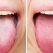 Warna Lidah Sebagai Cermin Kesehatan Tubuh dan Cara Mengenalinya