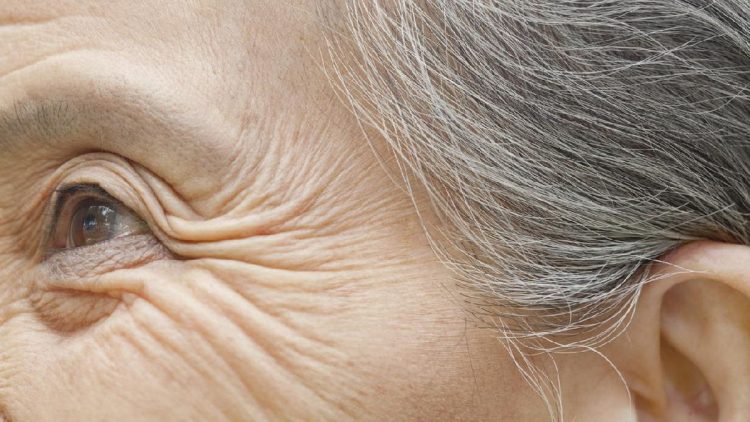 7 Penyebab Keriput di Bawah Mata yang Membuat Wajah Terlihat Lebih Tua